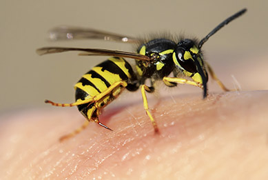 Wespe sitzt auf menschlicher Körperstelle und es erscheint eine allergische Reaktion